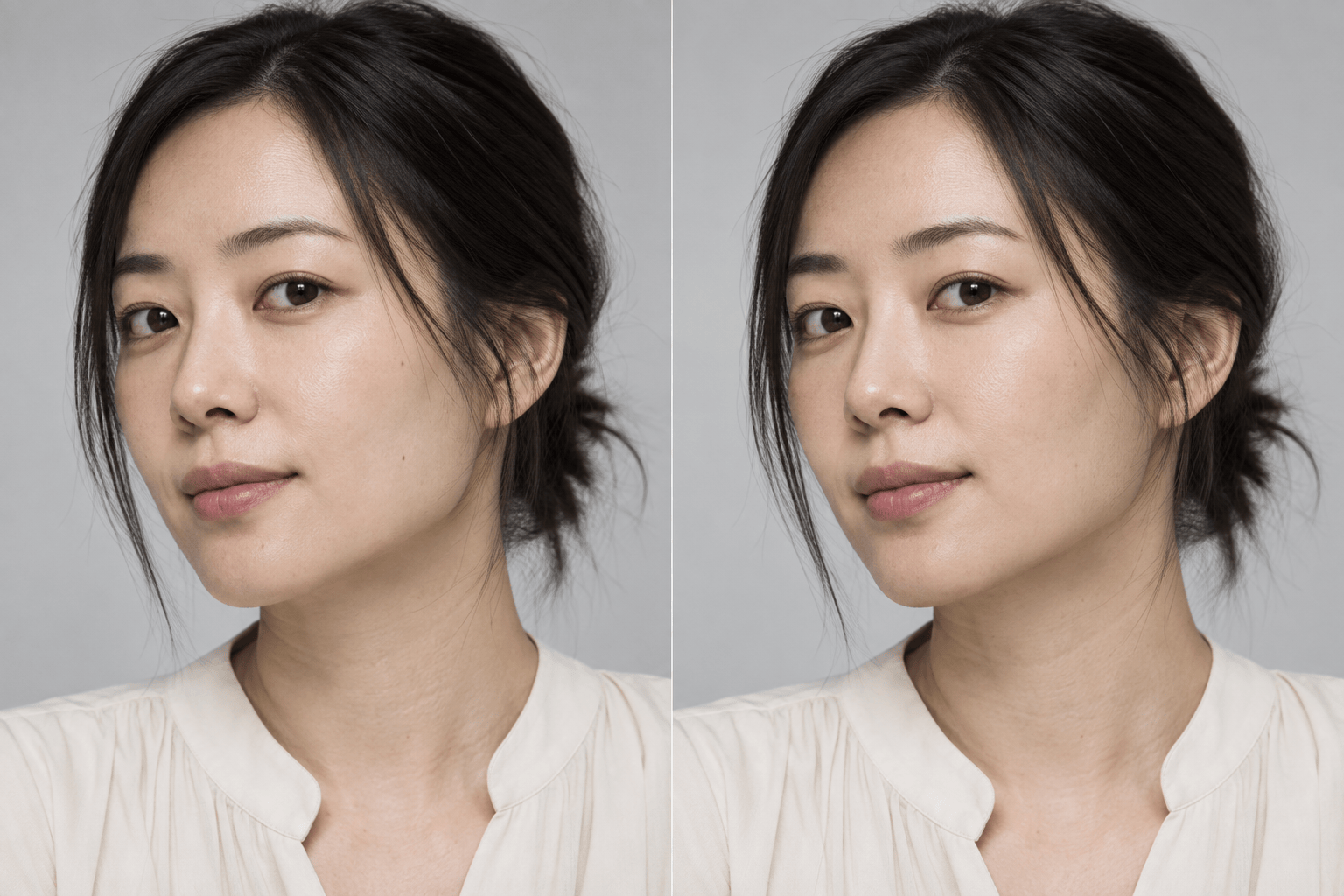 Softened jawline before and after